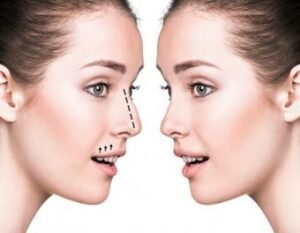 Useful Cosmetic Surgery Tips, Tricks, And Advice